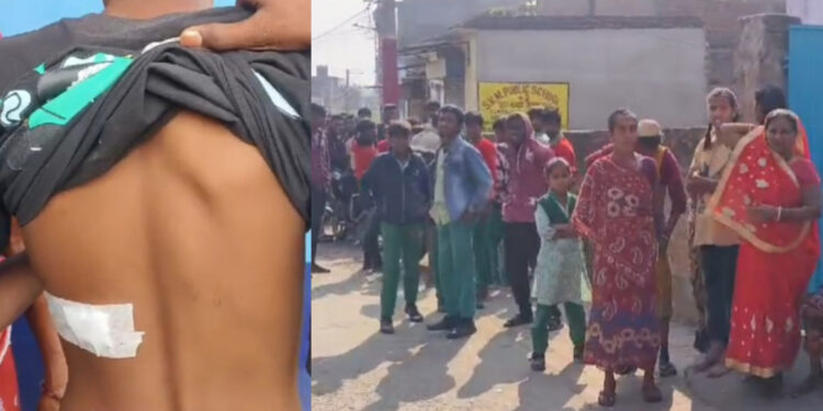 छात्रों ने बीच जमकर मारपीट चले चाकू-कैची, तीन घायल, पुलिस कर रही है जांच